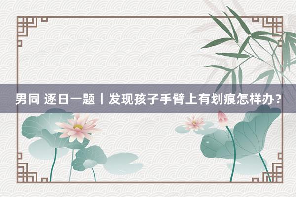 男同 逐日一题丨发现孩子手臂上有划痕怎样办？